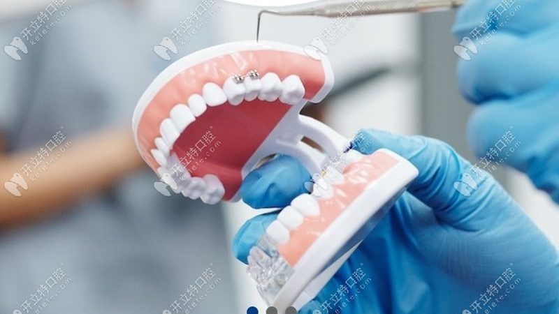 目前市场上儿童防龋齿牙刷种类繁多，大致可以分为以下几类：