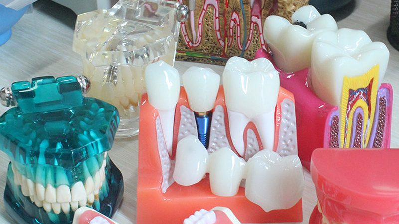 拔牙与根管治疗：哪种方式对身体影响更大？**