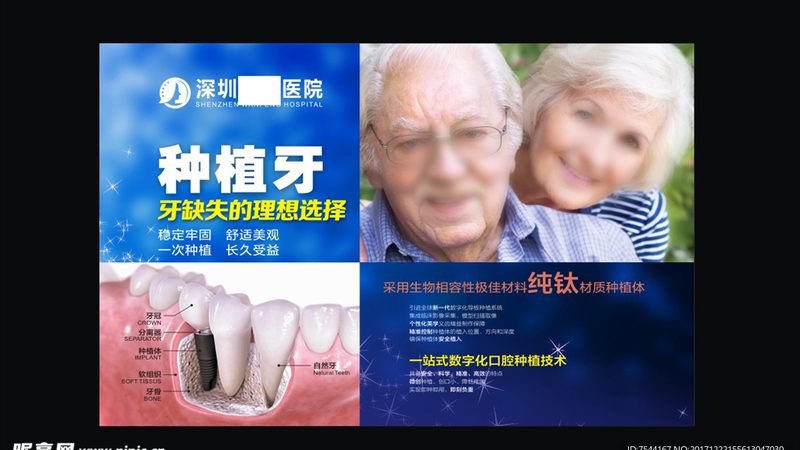 半口种植牙All-on-4，从检查到戴牙需要多久